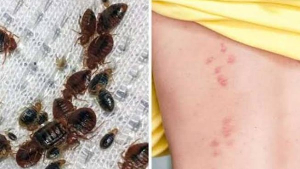 غزو بق الفراش للمنازل.. علامات وجوده وأفضل طرق التخلص منه فورًا 