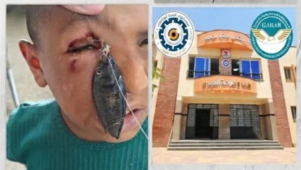 عودة بصر طفل