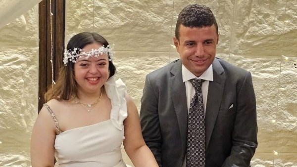 بعد تصدرهم الترند.. هل المتزوجون من متلازمة داون ينجبون أطفال مصابون؟