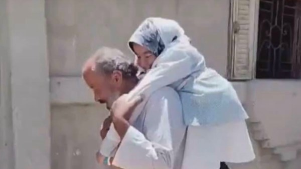 طبيب يعرض عملية مجانية لطالبة متفوقة تعاني من تشوه بالعمود الفقري