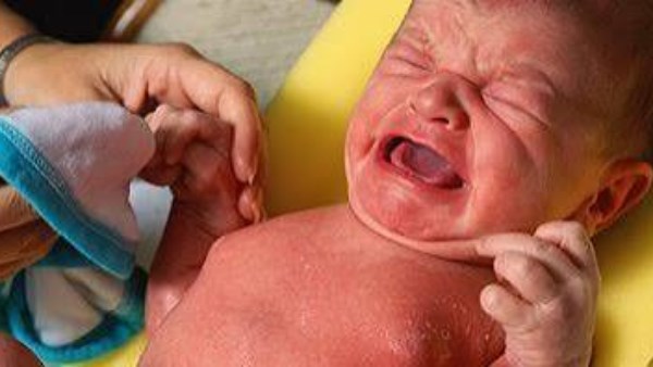 أعراض الجفاف عند الأطفال 