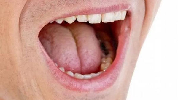 جفاف الفم رغم شرب المياه.. أسباب غير متوقعة وراء المشكلة 