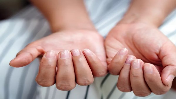 7 علامات صامتة لنقص الحديد عند النساء