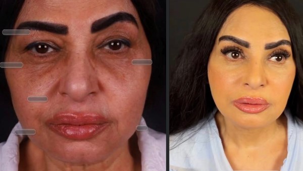 سلوى خطاب تثير الجدل بعمليات تجميل الوجه والرقبة