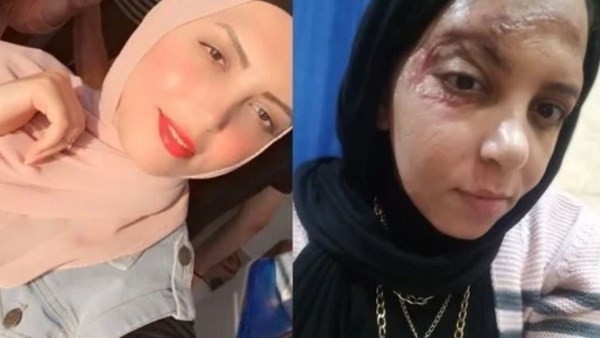 المجني عليها 