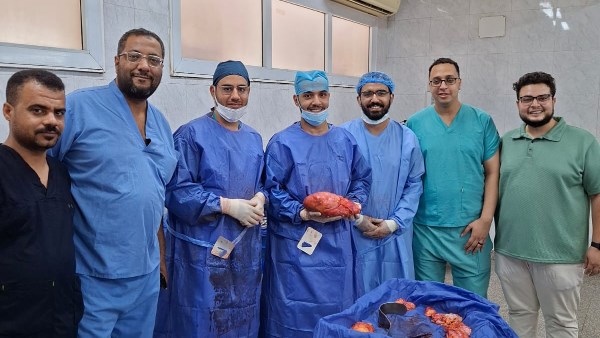 عقب عملية جراحية بالغة التعقيد لمريض يبلغ من العمر 80 عاما ..فريق طبي بقسم الجراحة العامة بجامعة أسيوط ينجح في استئصال ورم خبيث نادر وزنه 10 كيلوجرامات
