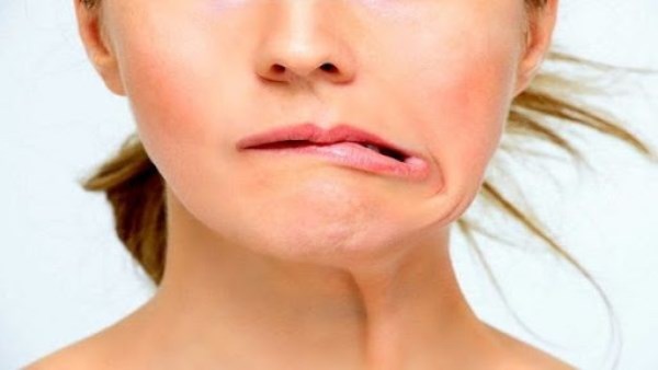 اعراض التهاب العصب السابع