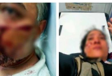 خلافات حول الميراث تنتهى بمشاجرة ومصابين بالمطرية