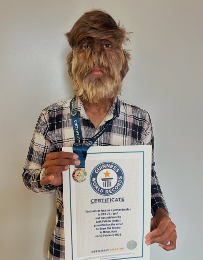 مستذئب هندي يدخل موسوعة جينيس.. ما القصة؟ صور 3 %D9%85%D8%B3%D8%AA%D8%B0 861 024341