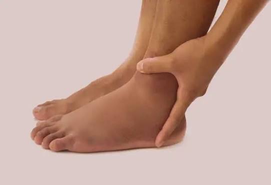 لو رجلك بتورم آخر اليوم.. متى يكون الأمر طبيعيًا ومتى يحتاج لطبيب؟