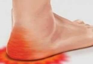 ألم كعب القدم عند الاستيقاظ؟