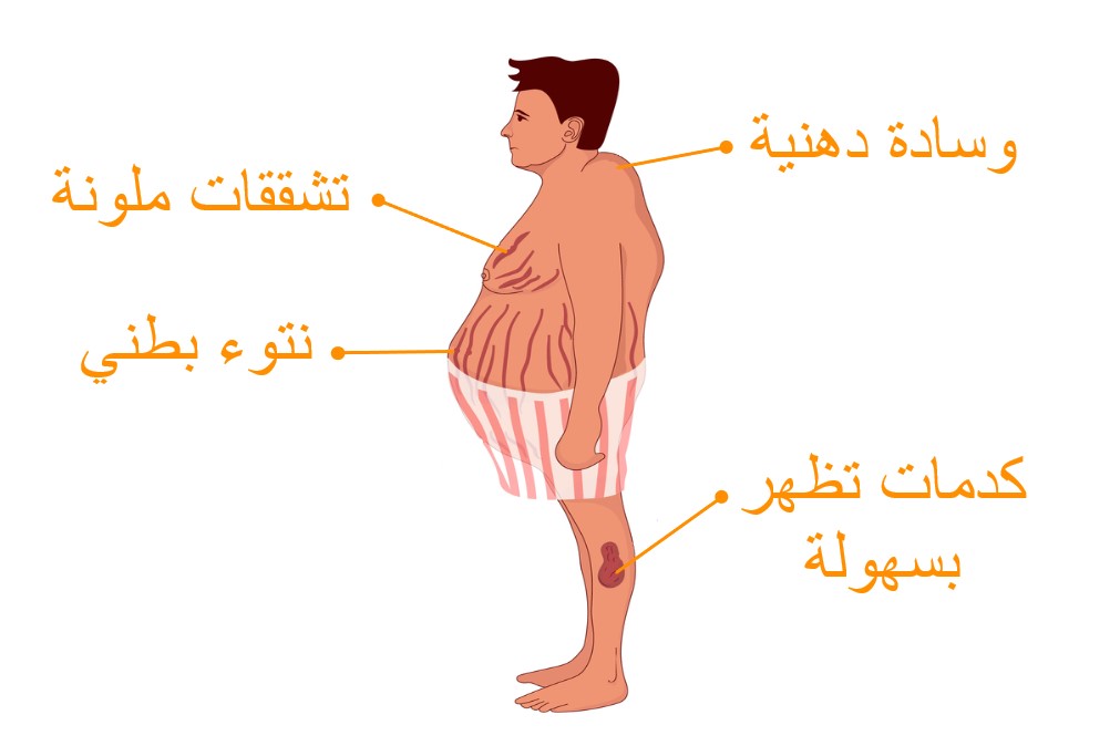 %D9%85%D8%AA%D9%84%D8%A7%D8%B2%D9%85%D8%