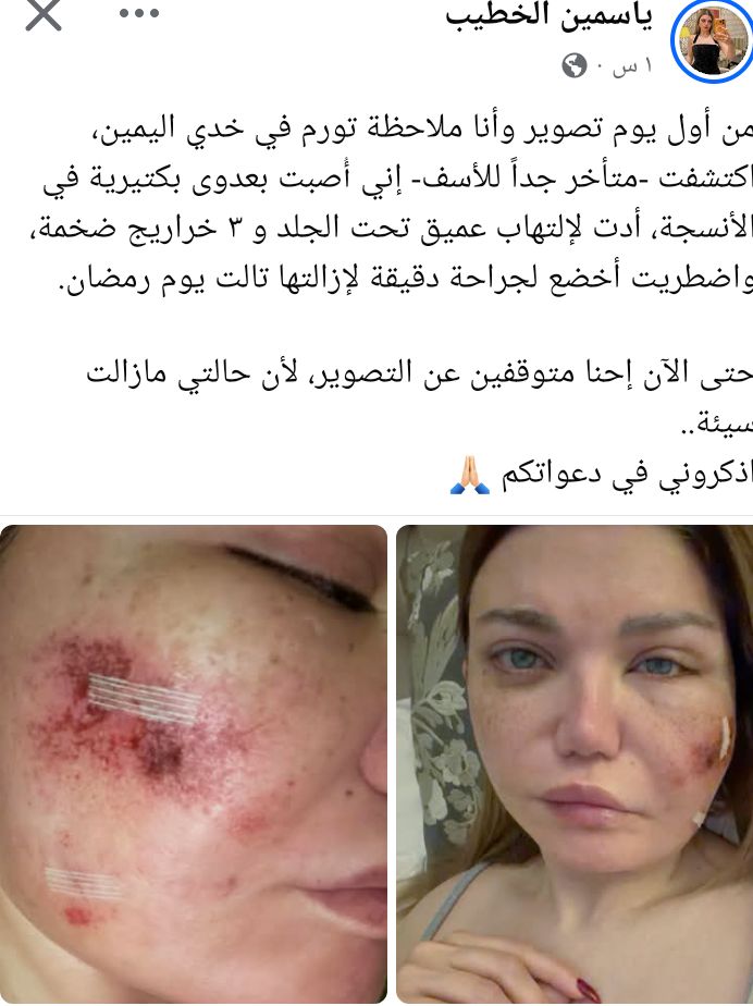 ياسمين الخطيب