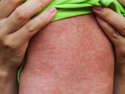 %D8%A7%D9%84%D8%AD%D8%B5%D8%A8%D8%A9_620